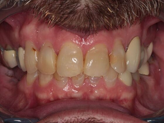 Before