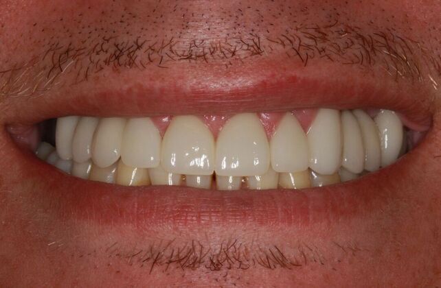 After