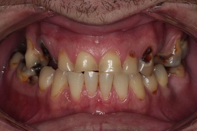 Before
