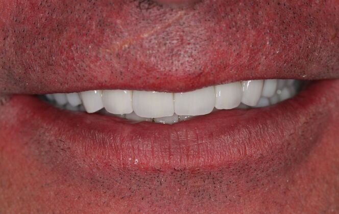 After
