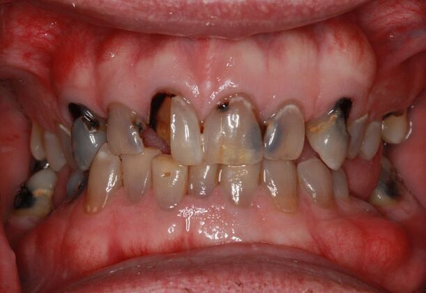 Before