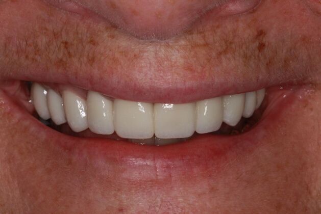 After