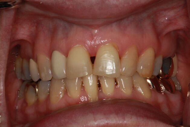 Before